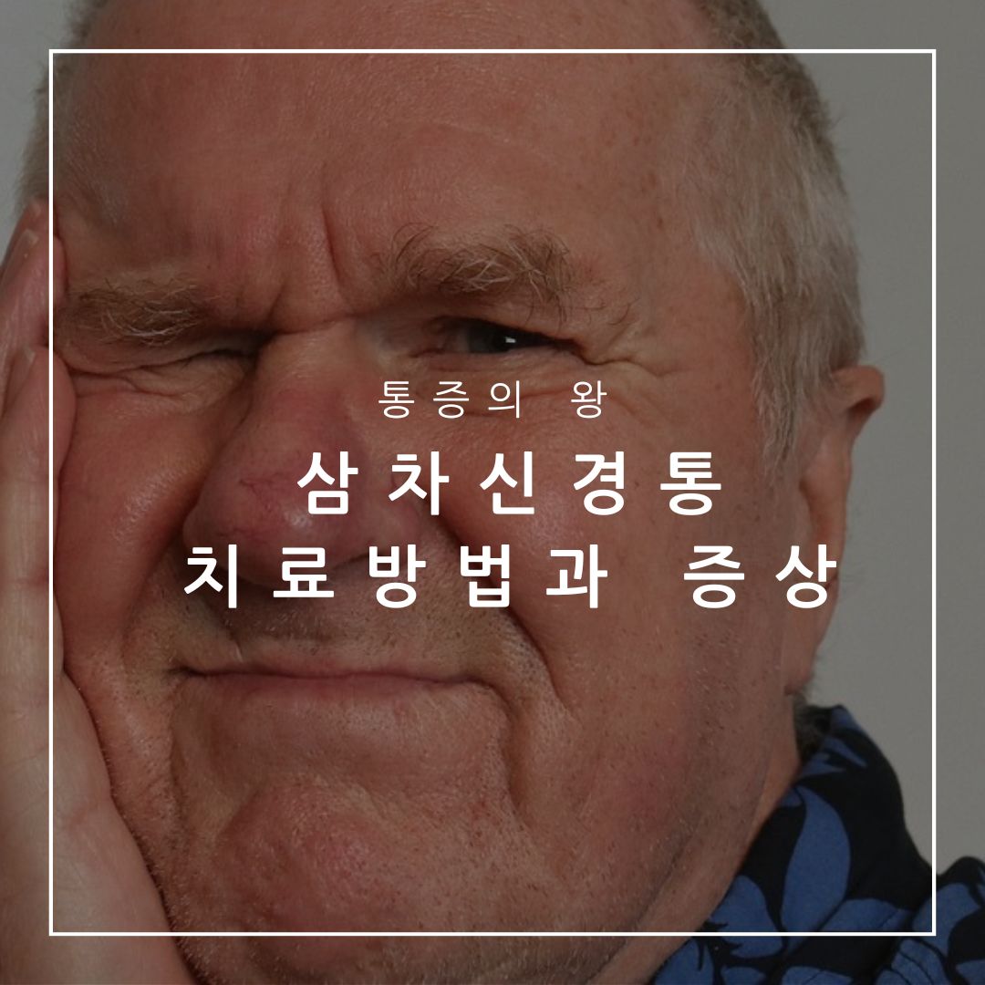 삼차신경통