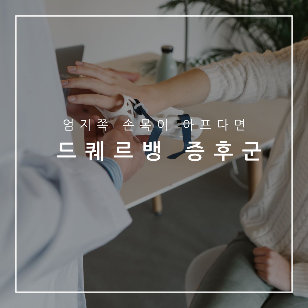 드퀘르뱅 증후군 치료