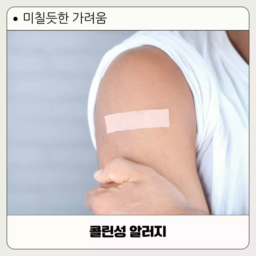 콜린성 알러지 치료 방법! 원인과 증상 한 번에 제대로 알아보기