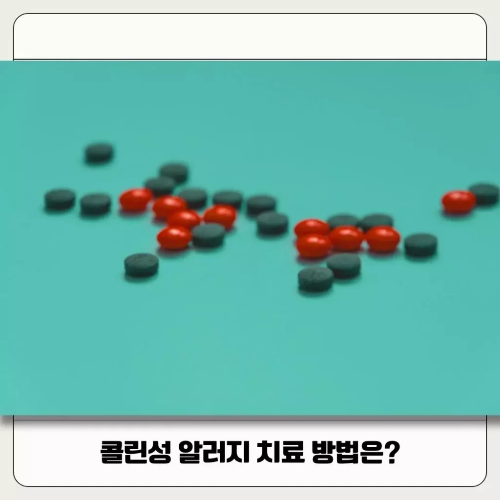 콜린성 알러지 치료 방법! 원인과 증상 한 번에 제대로 알아보기
