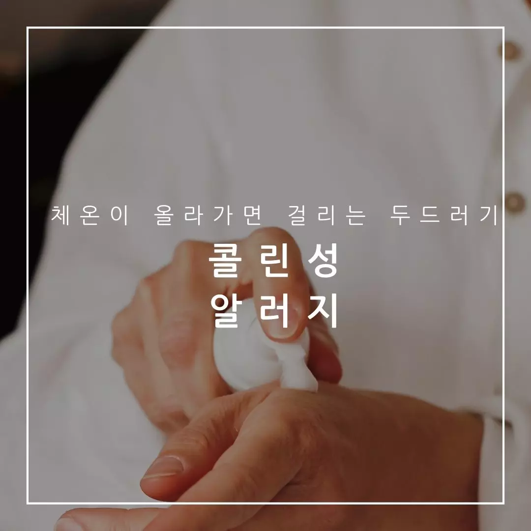 콜린성 알러지 치료 방법! 원인과 증상 한 번에 제대로 알아보기
