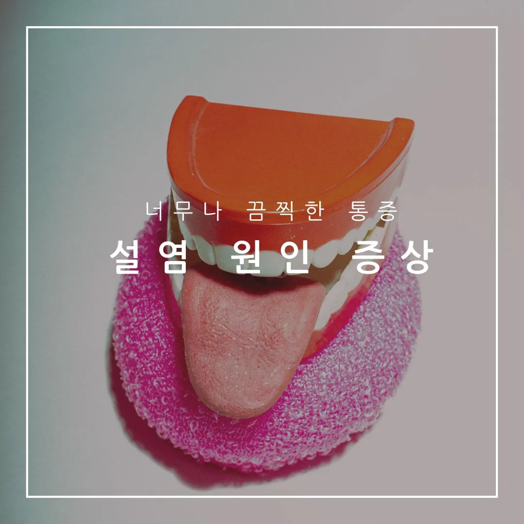직접 경험해보고 느낀 설염 원인 증상 빨리 낫는 법