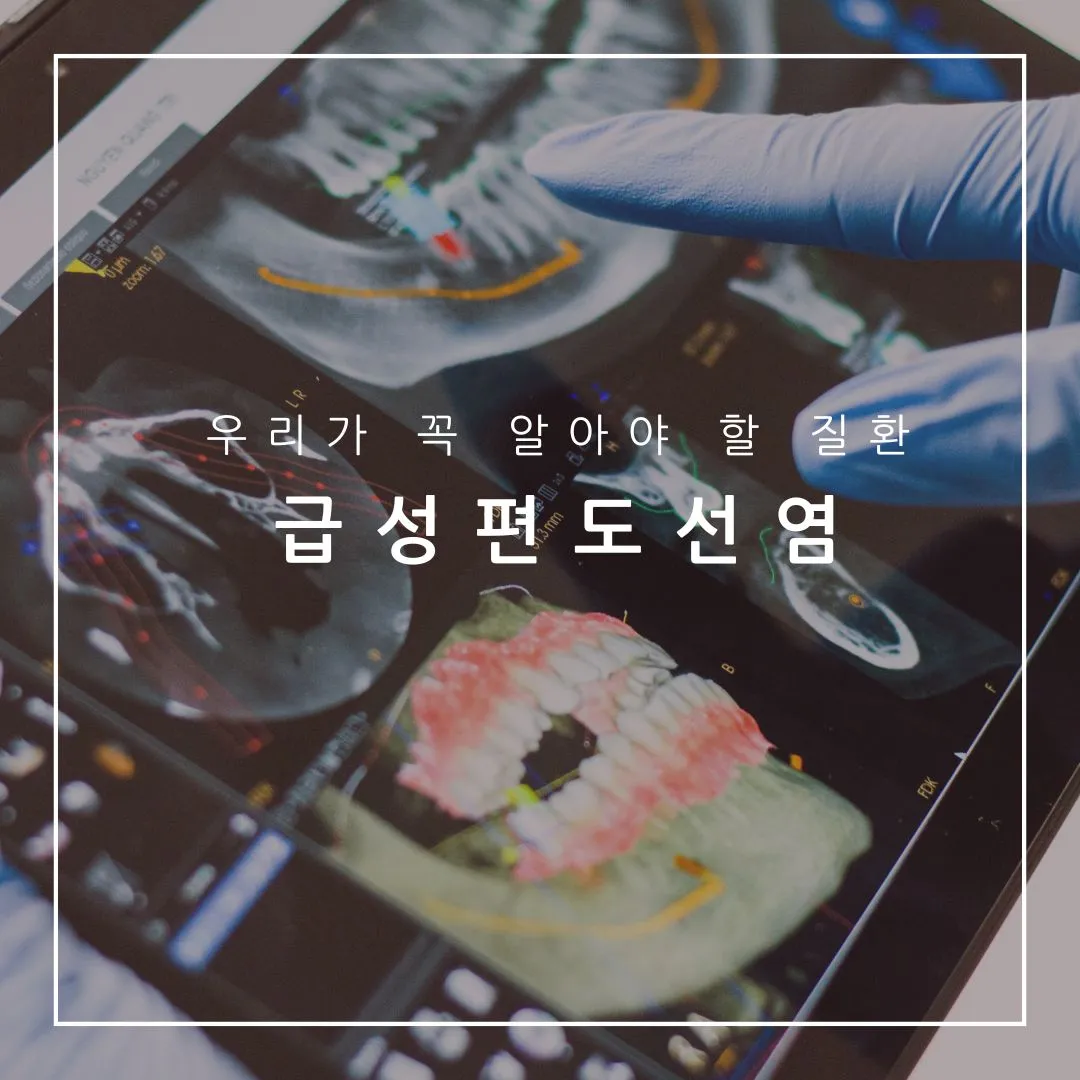 급성편도선염 제목