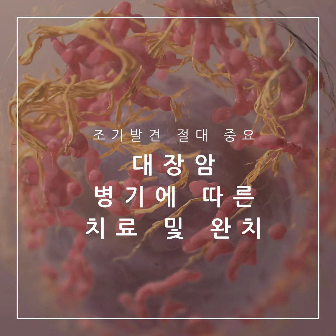 대장암 1기
