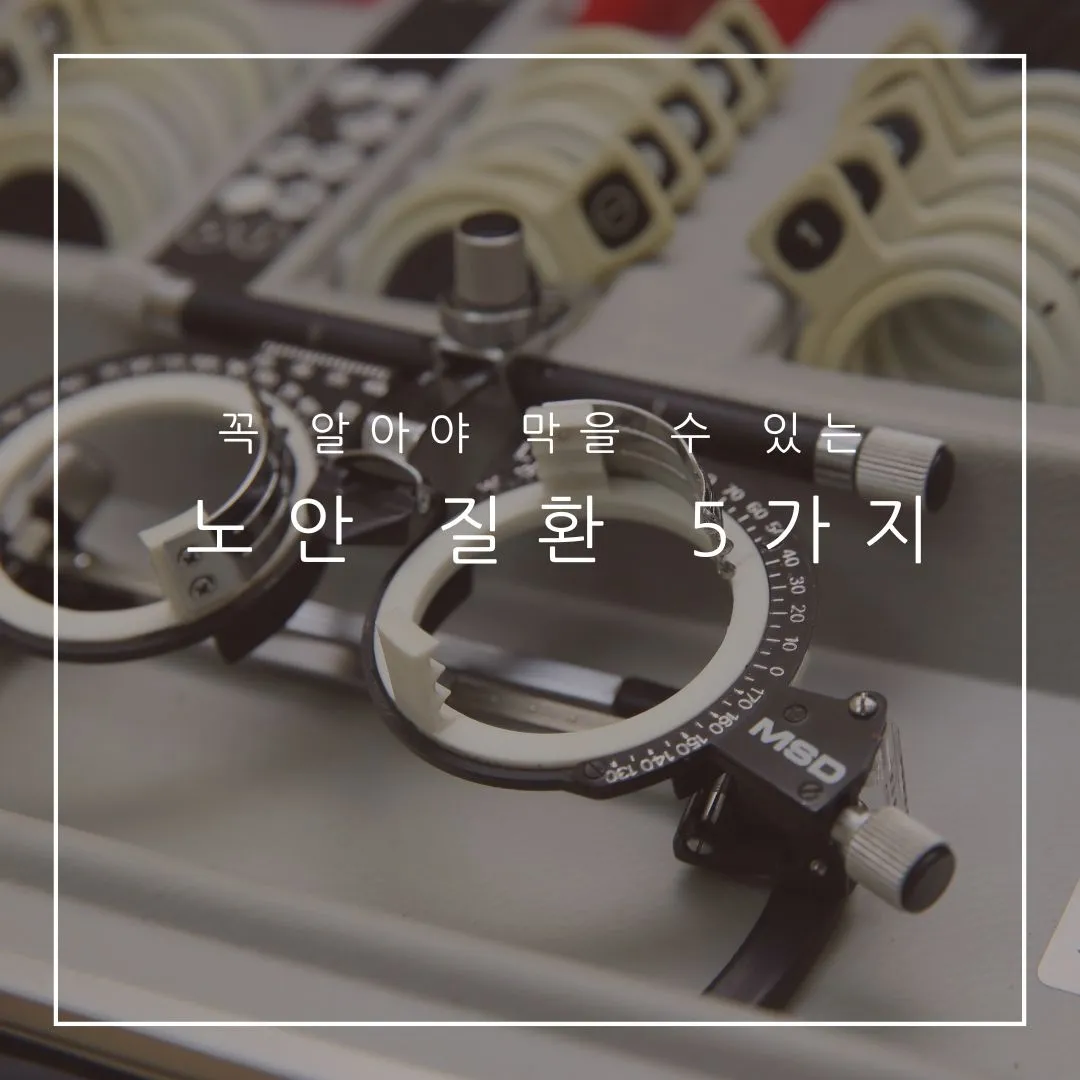 노안 원인