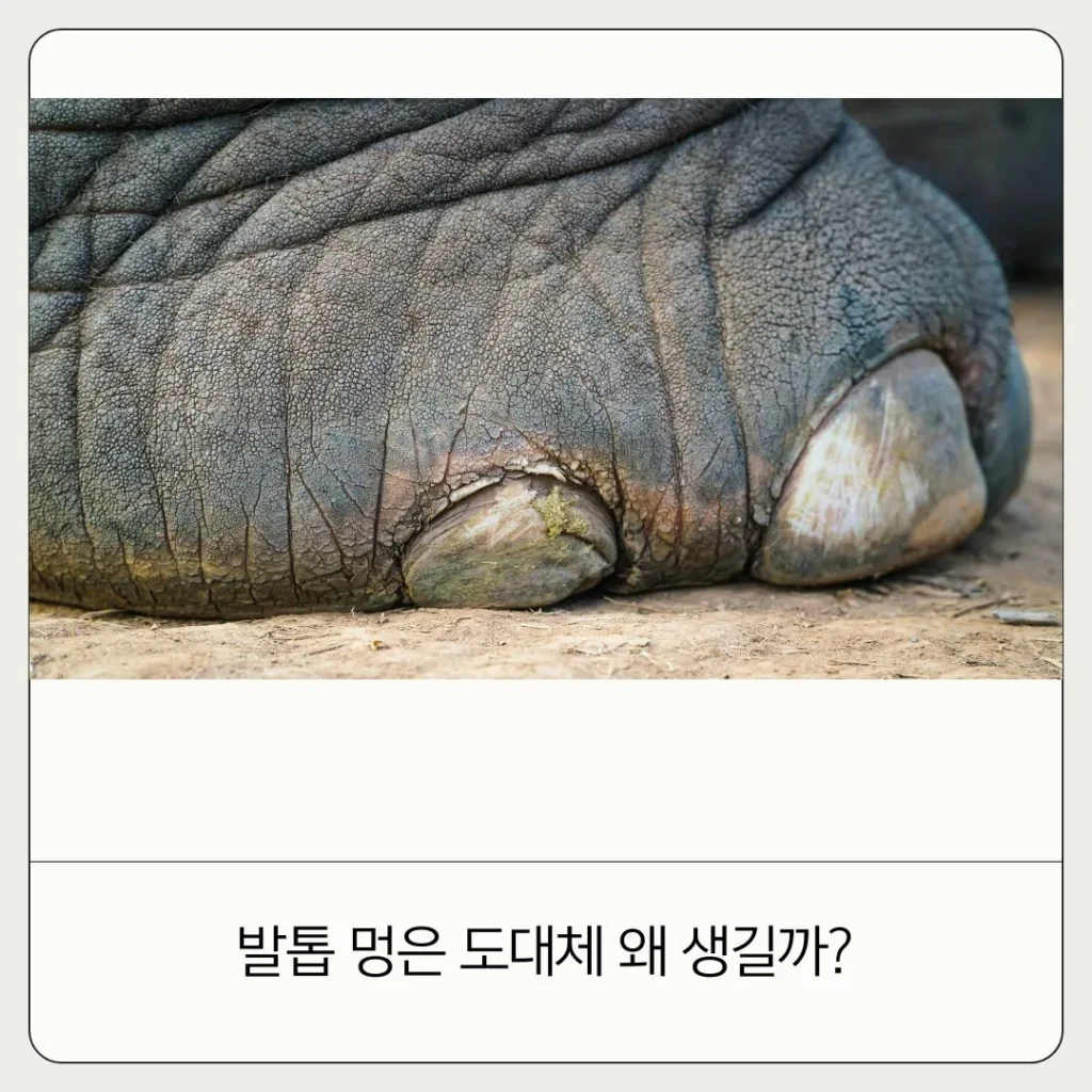 발톱 멍